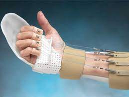 Elde Bükücü Tendon  (Fleksör Tendon ) Yaralanmalar�