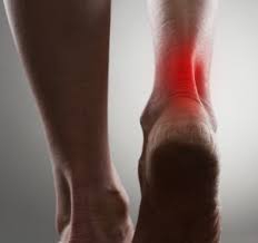 AŞİL TENDON CERRAHİSİ SONRASI REHABİLİTASYON SÜR
