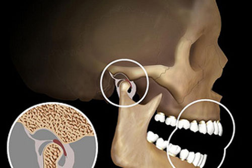 TEMPOROMANDİBULAR  EKLEM  DİSFONKSİYONU (TMD)